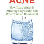 The Hidden Cause of Acne